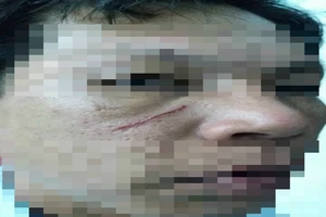 Xưng phóng viên, đánh công an xã