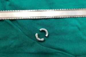 Vào viện cấp cứu vì đeo khoen kim loại cho dương vật