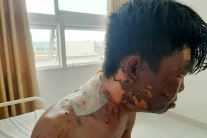 Mẹ ruột thanh niên bị chị tạt nước sôi trần tình