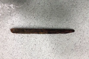 Cụ ông 70 tuổi té xe đạp, bị thanh gỗ đâm thủng phổi