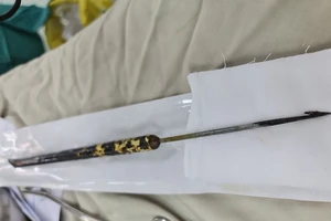 Đi săn chuột, người đàn ông bị chĩa đâm xuyên gan, phổi