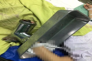 Người phụ nữ 'bồng' máy xay thịt vào bệnh viện cấp cứu