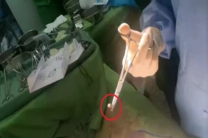 Trộm chó, thanh niên bị bắn suýt chết