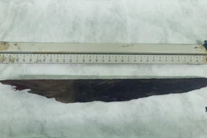 Bị cọc gỗ đâm xuyên ngực vì né con chó