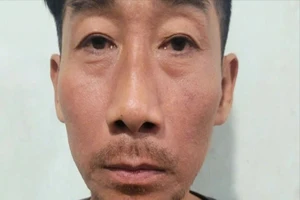 Công an Vĩnh Long tạm giữ hình sự người đàn ông đốt bạn nhậu 