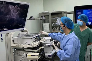 Lần đầu tiên thực hiện nội soi siêu âm tại Đồng bằng Sông Cửu Long