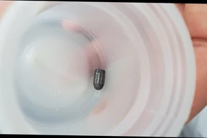 Cần Thơ: Đang làm vườn, 1 phụ nữ bị đạn bắn vào đầu