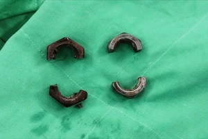 Đeo đai ốc kim loại cho 'cậu nhỏ' suốt 1 tháng, người đàn ông phải đi cấp cứu