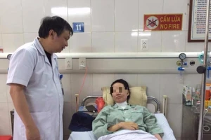 Bỏng toàn bộ vùng mặt do bóng bay phát nổ