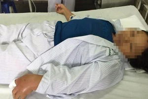 Đi bắt rắn nước bán, bị rắn hổ mang cắn nhập viện