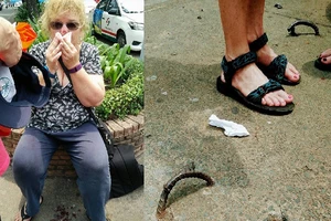 Móc sắt làm khách Tây té 'dập mặt' đã được gỡ bỏ