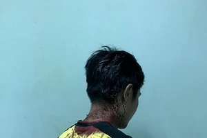 Hơn 20 người xông vào đập phá 5 phòng trọ 