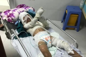 Em gái mang xăng qua nhà chị đòi nợ, cháu 6 tuổi bỏng nặng