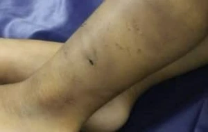 Nghi vấn cháu bé 2 tuổi bị bạo hành đến hôn mê
