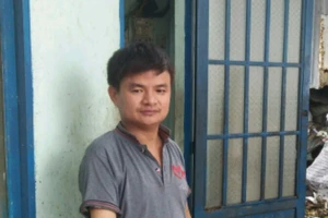 Bị mất một cánh tay đòi bồi thường bao nhiêu?