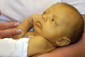 Xuất hiện bệnh viêm gan bí ẩn ở trẻ em từ 1-6 tuổi ở Mỹ, châu Âu