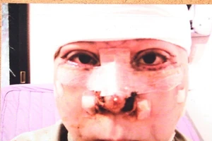 Phẫu thuật thẩm mỹ bị biến chứng, thưa kiện ở đâu?