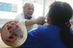 Hiểm họa từ nâng ngực bằng silicon giá rẻ