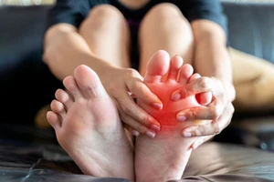 5 loại trái cây khô giúp giảm axit uric tự nhiên, tốt cho người bệnh gút