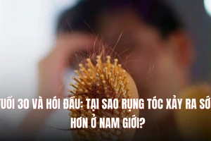 Tuổi 30 và hói đầu: Tại sao rụng tóc xảy ra sớm hơn ở nam giới?