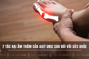 7 tác hại âm thầm của axit uric cao đối với sức khỏe 