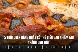 5 thói quen hàng ngày có thể biến gan nhiễm mỡ thành ung thư 