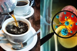 Người bị bệnh thận có nên uống cà phê không? 