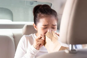 10 cách đơn giản giúp giảm say xe khi đi chơi Tết