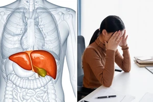 Lối sống hiện đại đang âm thầm gây hại cho sức khỏe gan như thế nào? 