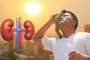 Cơ thể thiếu nước giữa nắng nóng, thận có thể chịu tổn thương nghiêm trọng 