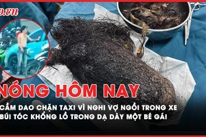 Nóng hôm nay: Cầm dao chặn taxi vì nghi vợ ngồi trong xe; Búi tóc khổng lồ trong dạ dày một bé gái