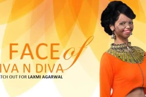 Cô gái bị tạt acid làm người mẫu thời trang