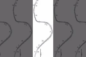 Loài ký sinh trùng mang tên của Tổng thống Obama