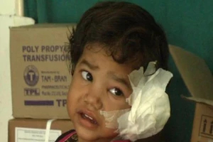 Nhặng xanh làm tổ đẻ 80 trứng trong tai bé gái 4 tuổi