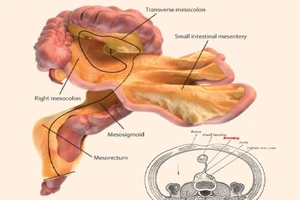 Cơ thể người có thêm bộ phận nội tạng mới