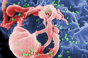 Thêm bệnh nhân thứ 3 chữa khỏi HIV
