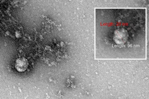 Nga có hình ảnh đầu tiên về biến thể SARS-CoV-2 ở Anh