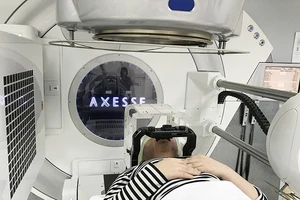 Xạ phẫu thành công cho bệnh nhân bị động kinh kháng thuốc