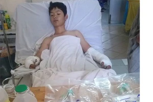 Thả diều bị điện giật, cháy xém hạ bộ