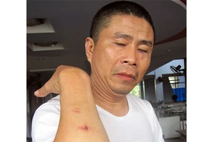 Kéo côn đồ chặn xe khách, đánh người