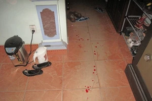 Bưu phẩm phát nổ, 1 nữ kế toán bị thương