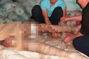 Vợ đòi đi TP HCM, chồng tẩm xăng tự thiêu