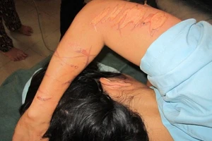 Khởi tố 3 đối tượng nhốt, tra tấn phụ nữ như thời trung cổ