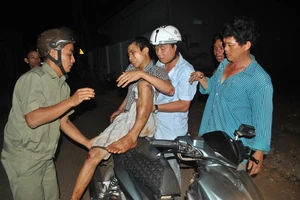 Bị truy bắt, tên trộm té gãy ống chân