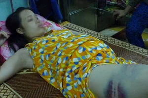 Chồng đánh nhập viện vì đi khám thai không trình báo