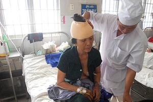 Bỏng do bị chập điện thoại bàn