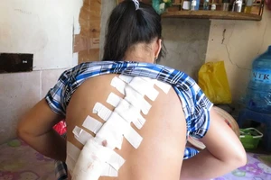 Một thiếu nữ bị giang hồ Sài Gòn chém rách lưng