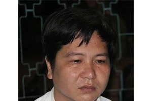 Phó phòng giáo dục huyện bị tạt axít thương tật 28%