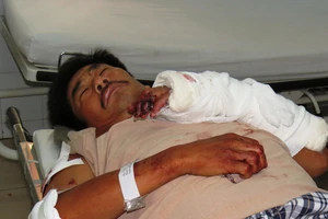 Trạm trưởng bảo vệ rừng bị chém gần lìa bàn tay