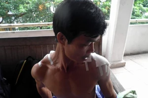 Nhóm côn đồ chém khách hát ở quán karaoke